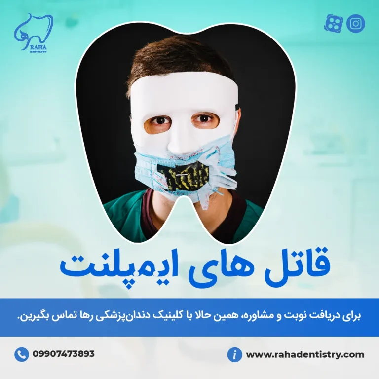 قاتل‌های ایمپلنت دندان - دندانپزشکی رها