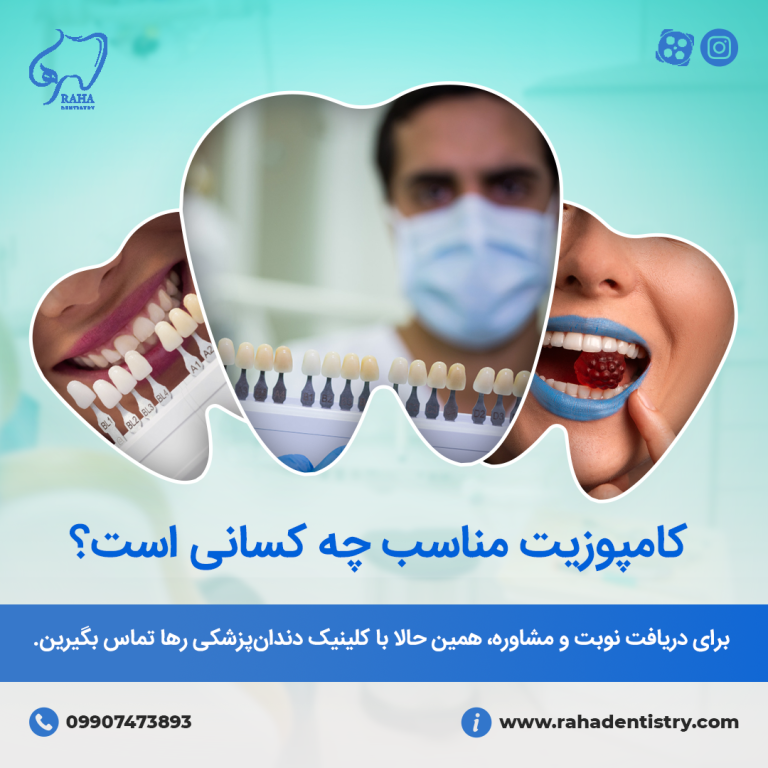 کامپوزیت مناسب چه کسانی است؟ - دندانپزشکی رها