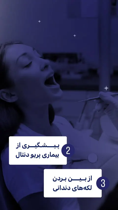 5 مورد از مهم ترین فواید جرم گیری دندان - مطب دندانپزشکی رها کرج