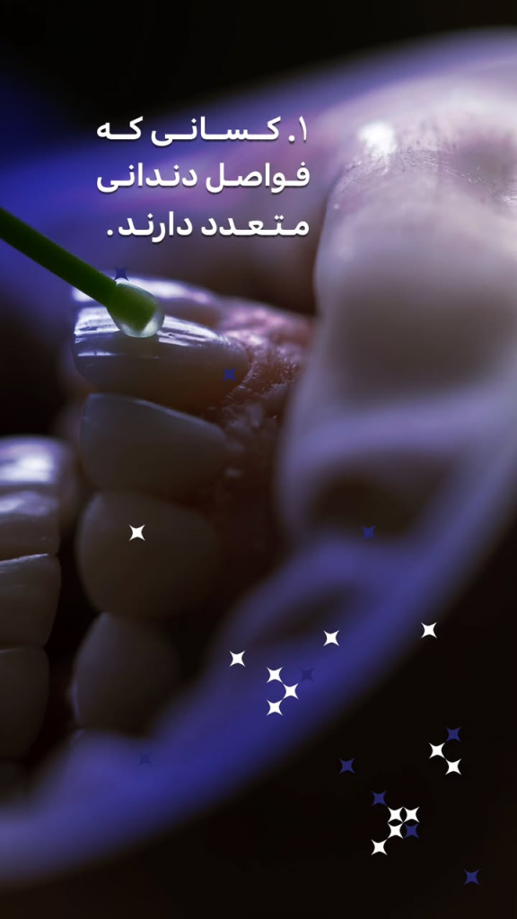 دندان پزشکی رها، کامپوزیت مناسب چه کسانی هست؟