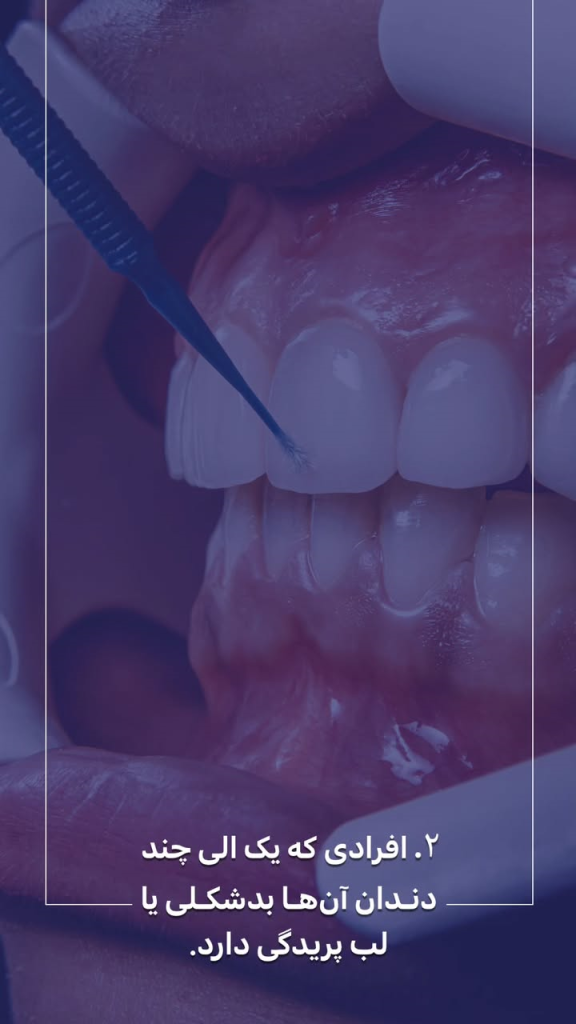 دندان پزشکی رها، کامپوزیت مناسب چه کسانی هست؟