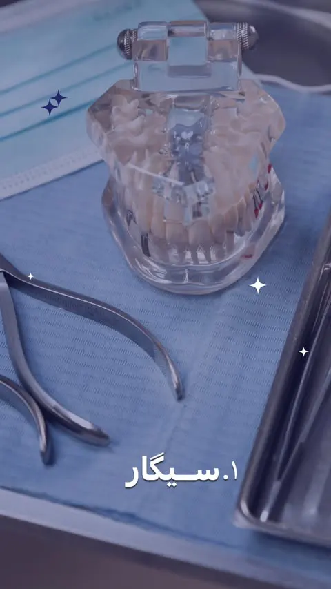 قاتل‌های ایمپلنت دندان - مطب دندانپزشکی رها