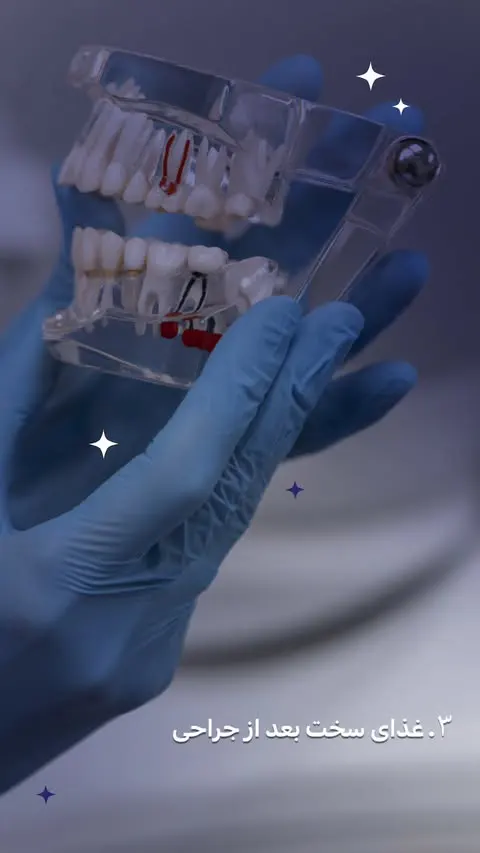 قاتل‌های ایمپلنت دندان - مطب دندانپزشکی رها