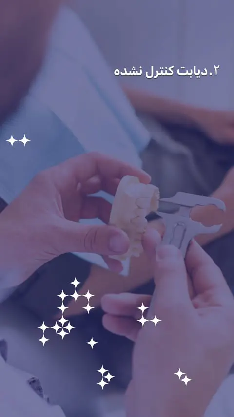 قاتل‌های ایمپلنت دندان - مطب دندانپزشکی رها