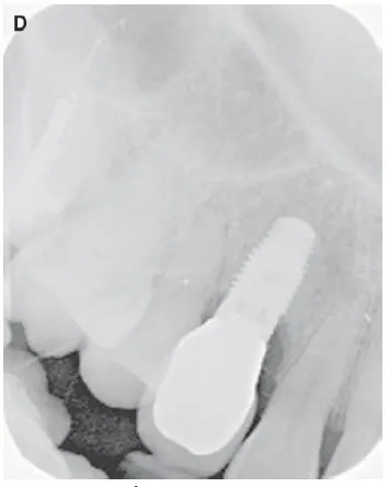 شکل VII‑8 (ادامه)